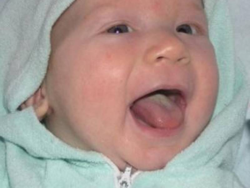 Белый налет на языке у малыша: причины, лечение заболеваний, сопутствующие симптомы