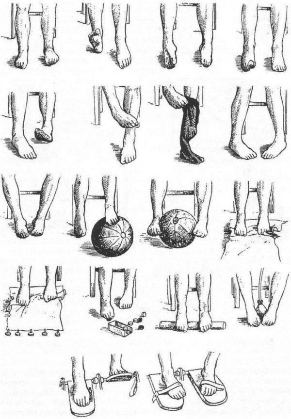 Деформирующий артроз коленного сустава | артракам