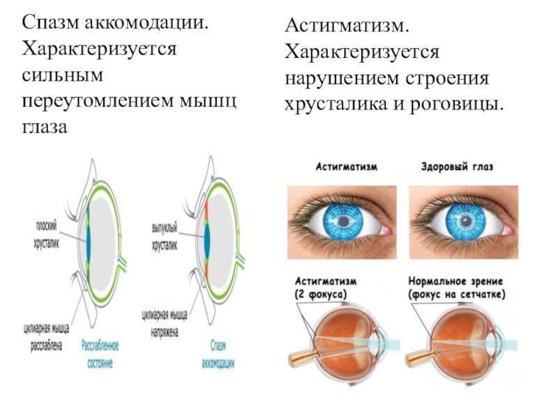 Физиотерапевтическое лечение заболеваний глаз