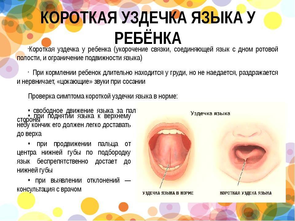 Пластика уздечки верхней губы у детей и показания к ней | лазерная пластика уздечки верхней губы