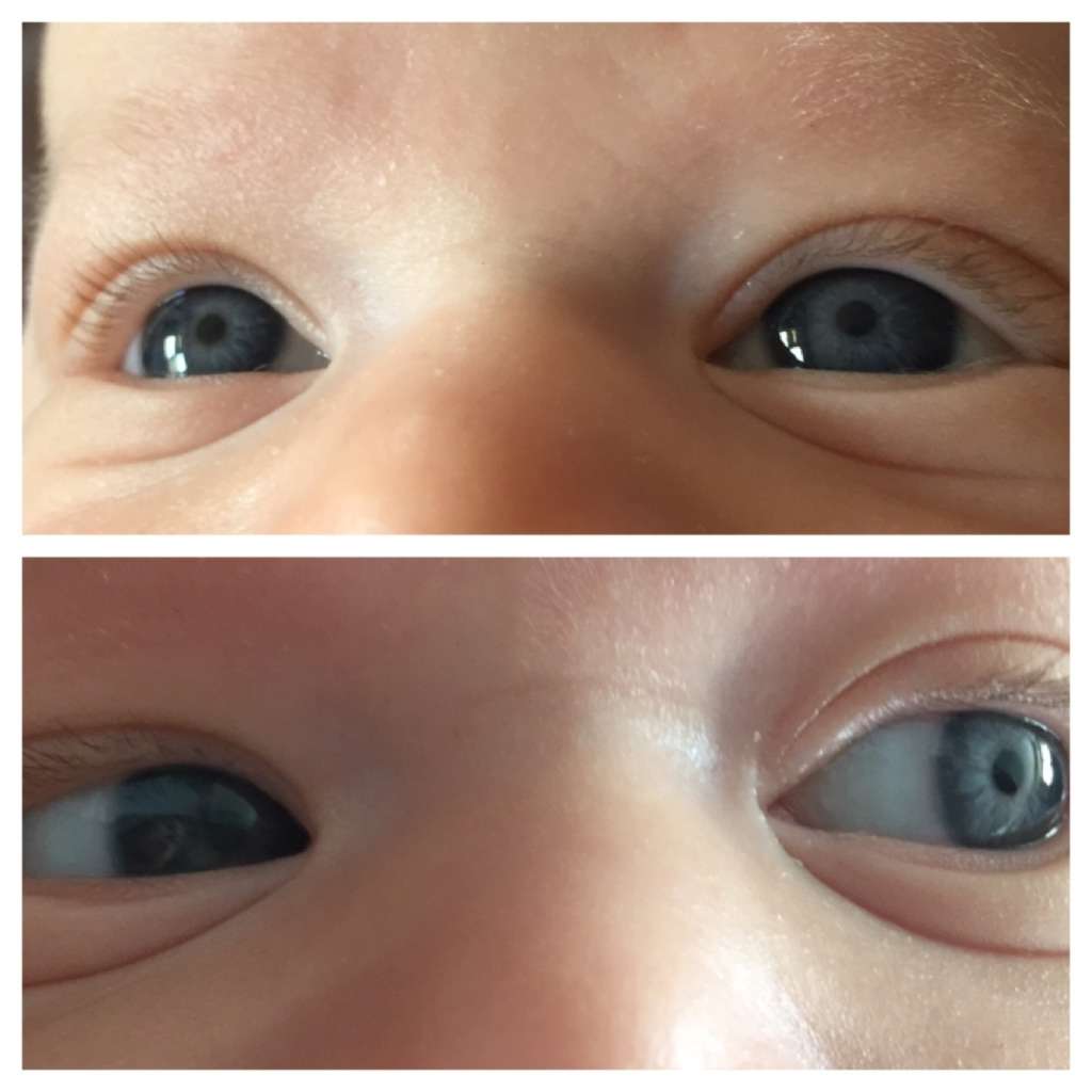 Цвет глаз у младенцев: как меняется и каким будет