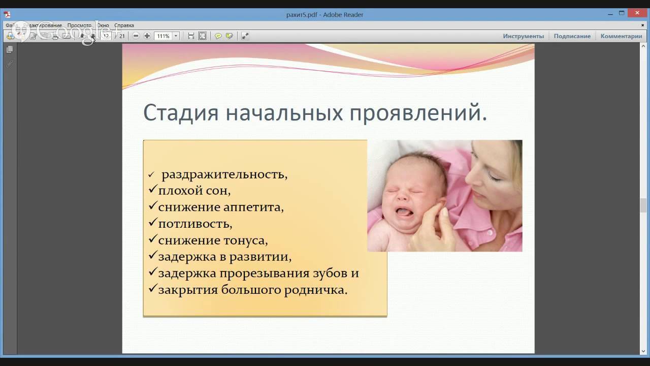 Профилактика рахита у детей до года и после. лечение рахита у новорожденных и грудничков.