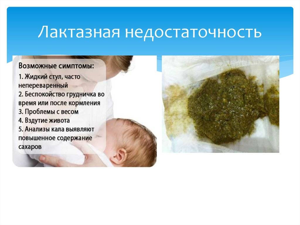 Лактазная недостаточность (непереносимость лактозы) у грудничков