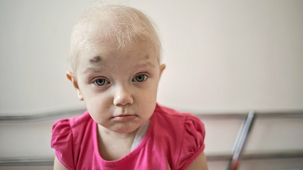 Рак Фотографии Болезнь