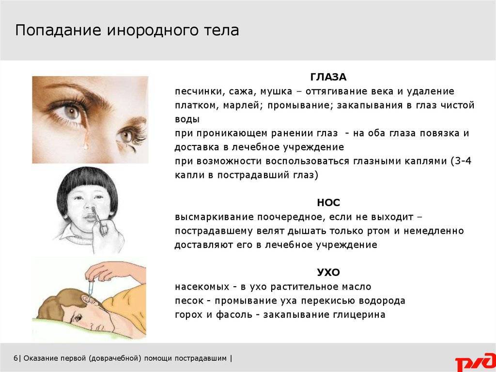 Повреждение роговицы у детей - симптомы болезни, профилактика и лечение повреждения роговицы у детей, причины заболевания и его диагностика на eurolab