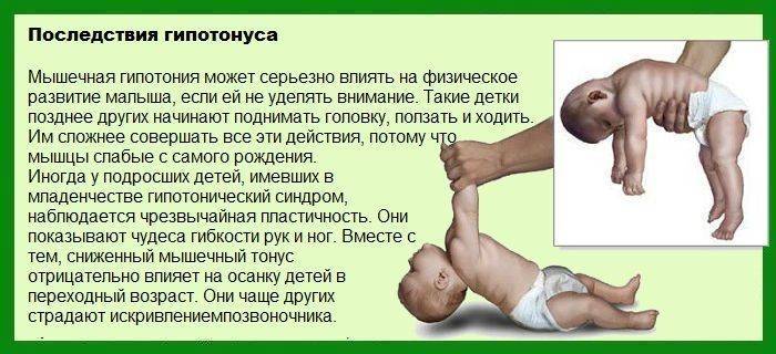 Гимнастика и массаж при нарушении цнс у детей - «доктор гален» консультация ортопеда, травматолога, ревматолога. обследование. лечение. медицинские изделия.
