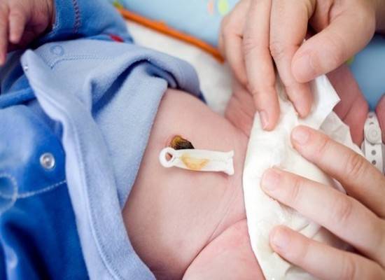 Кровит пупок у новорожденных: что делать и почему так происходит
