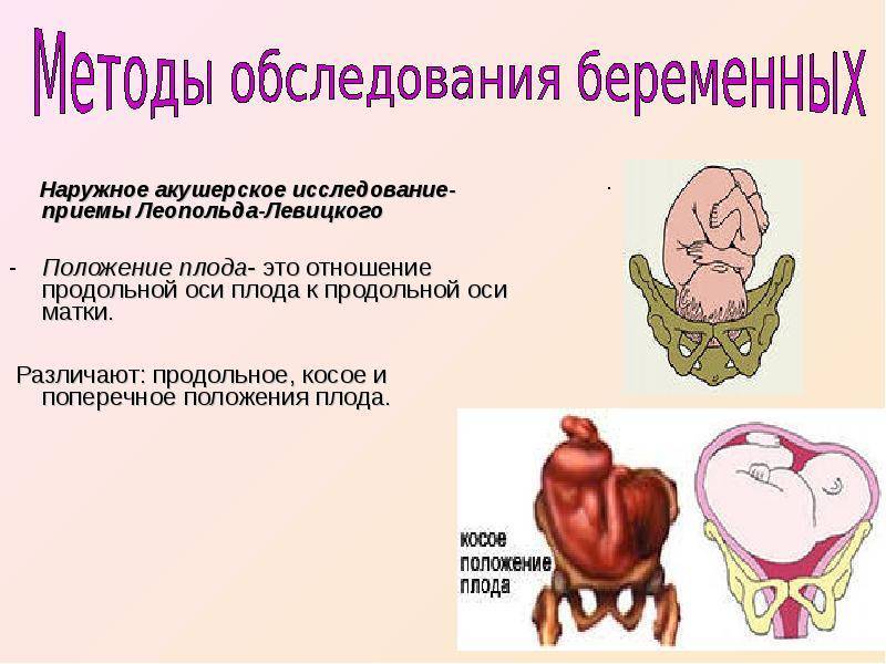 Косое и поперечное положение плода презентация