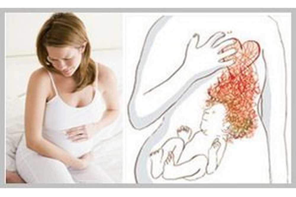 Дисбактериоз у беременных: причины и симптомы, терапия, опасность для плода. бифилакт биота