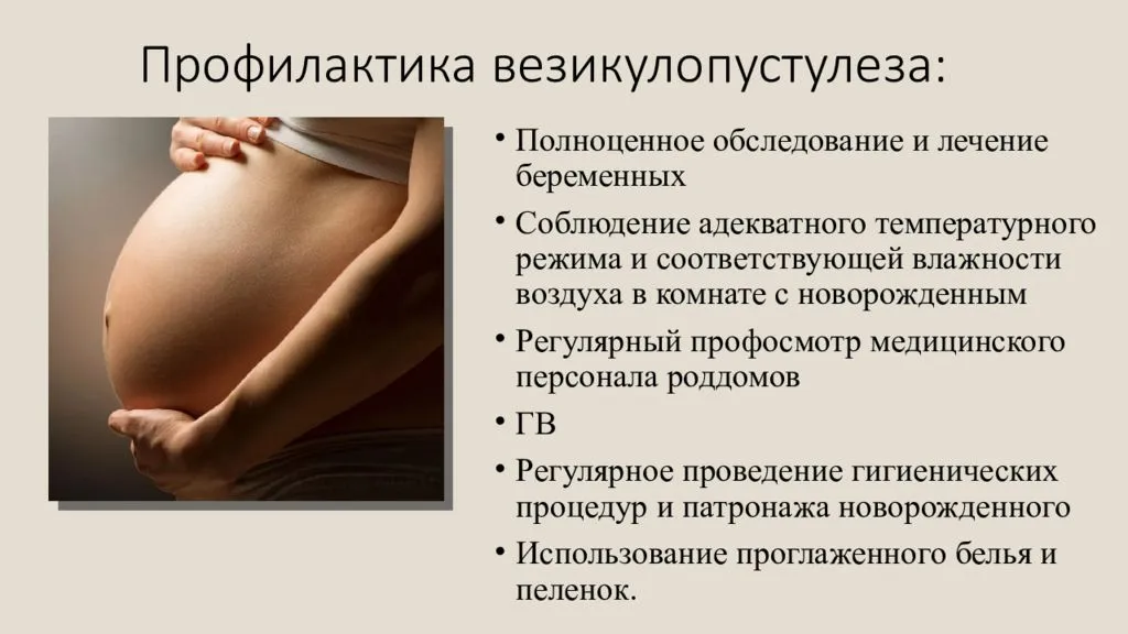 Детская эпилептология (разина е.е.)