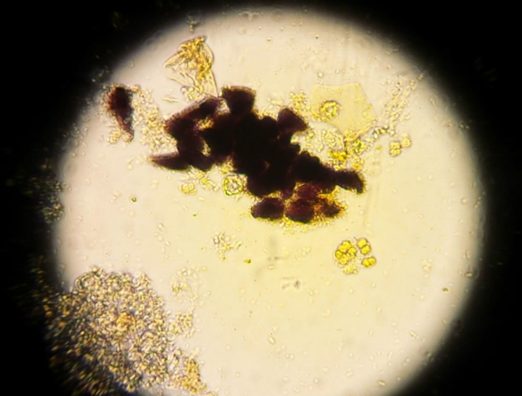 Бактерии в копрограмме. Микроскопия кала крахмал. Копрограмма микроскопия. Внеклеточный крахмал в микроскопии кала. Зерна крахмала в Кале микроскопия.