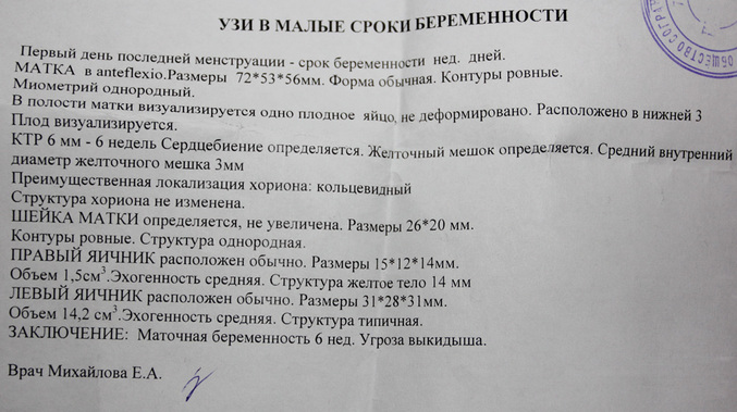 Признаки и симптомы угрозы выкидыша на раннем сроке беременности, до 2 недель, как происходит самопроизвольный аборт