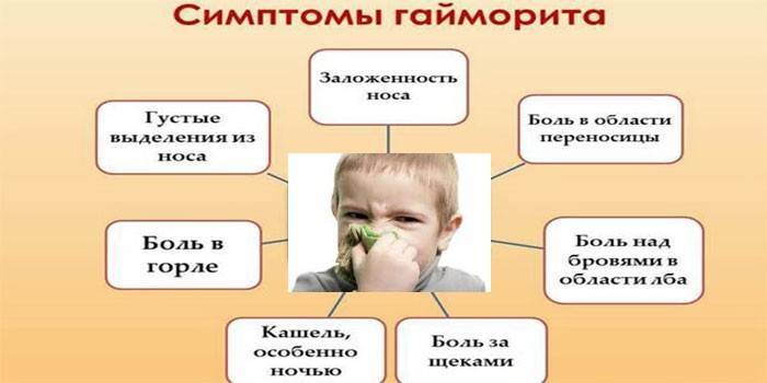 Синусит: симптомы и лечение у взрослых - как лечить острый синусит