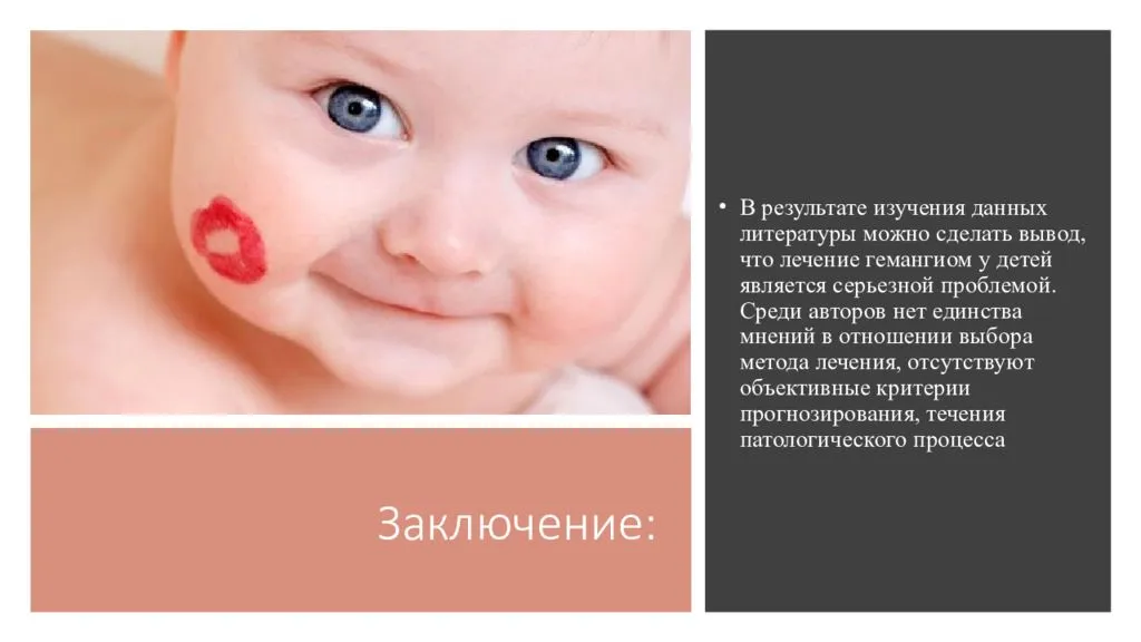 Гемангиома у новорожденных: фото, причины возникновения, лечение (удаление)