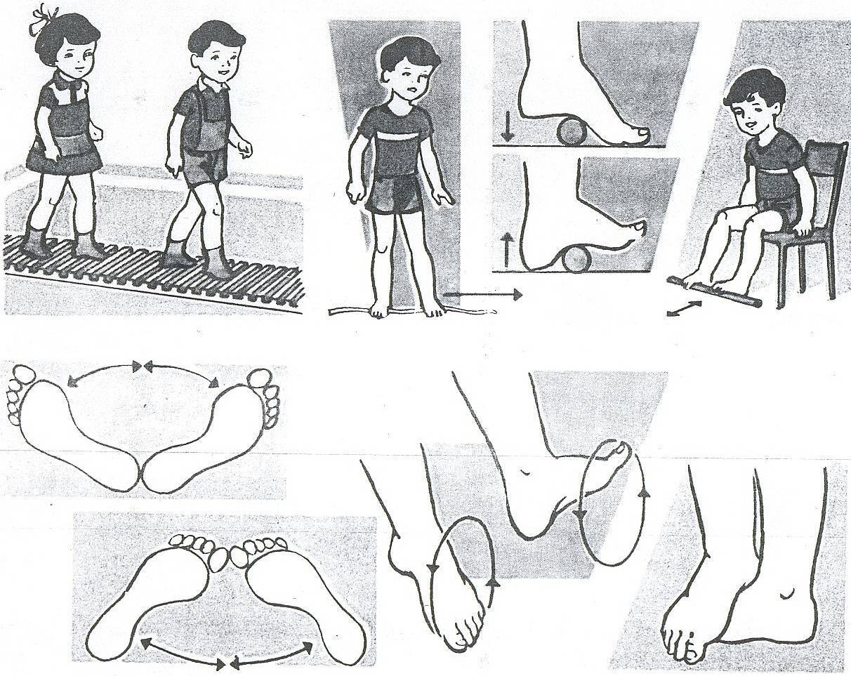 Гимнастика для профилактики плоскостопия у детей