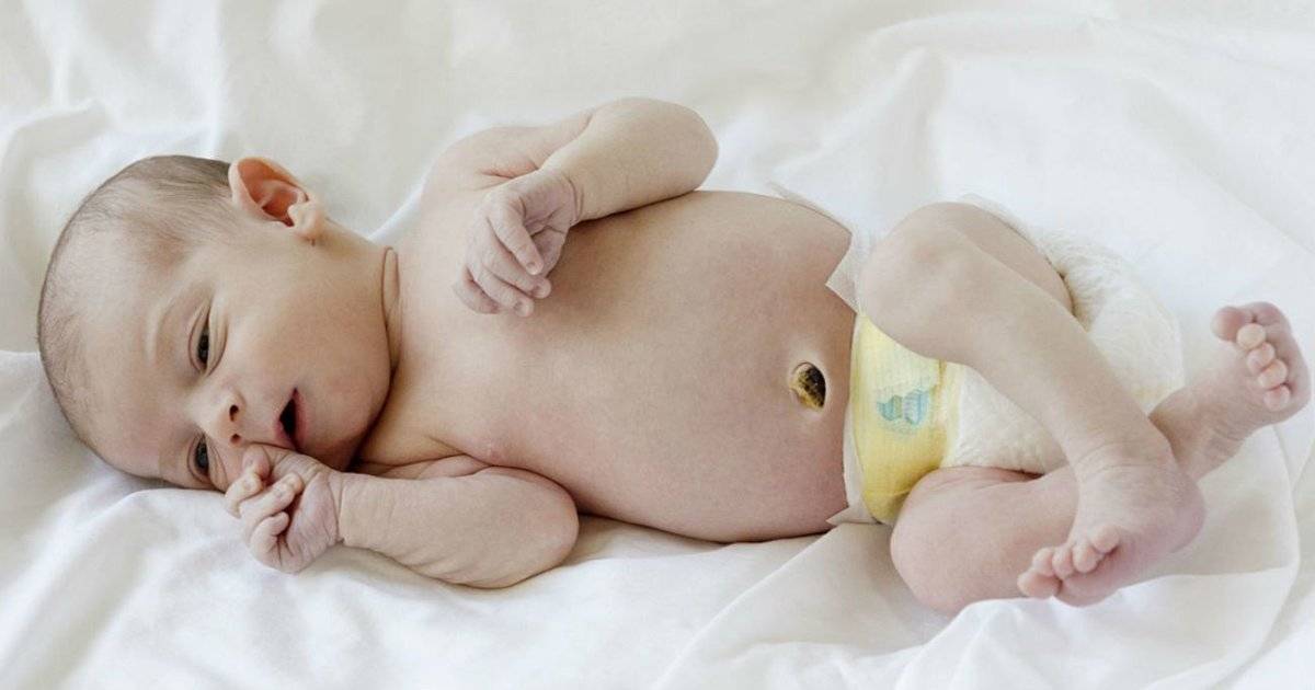 Фунгус пупка (гранулема) у новорожденных: причины, лечение и последствия
