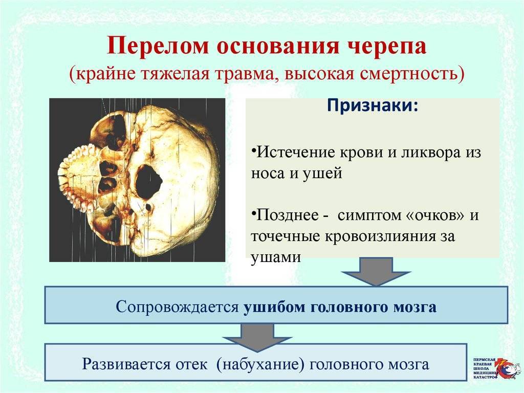 Перелом основания черепа карта вызова смп