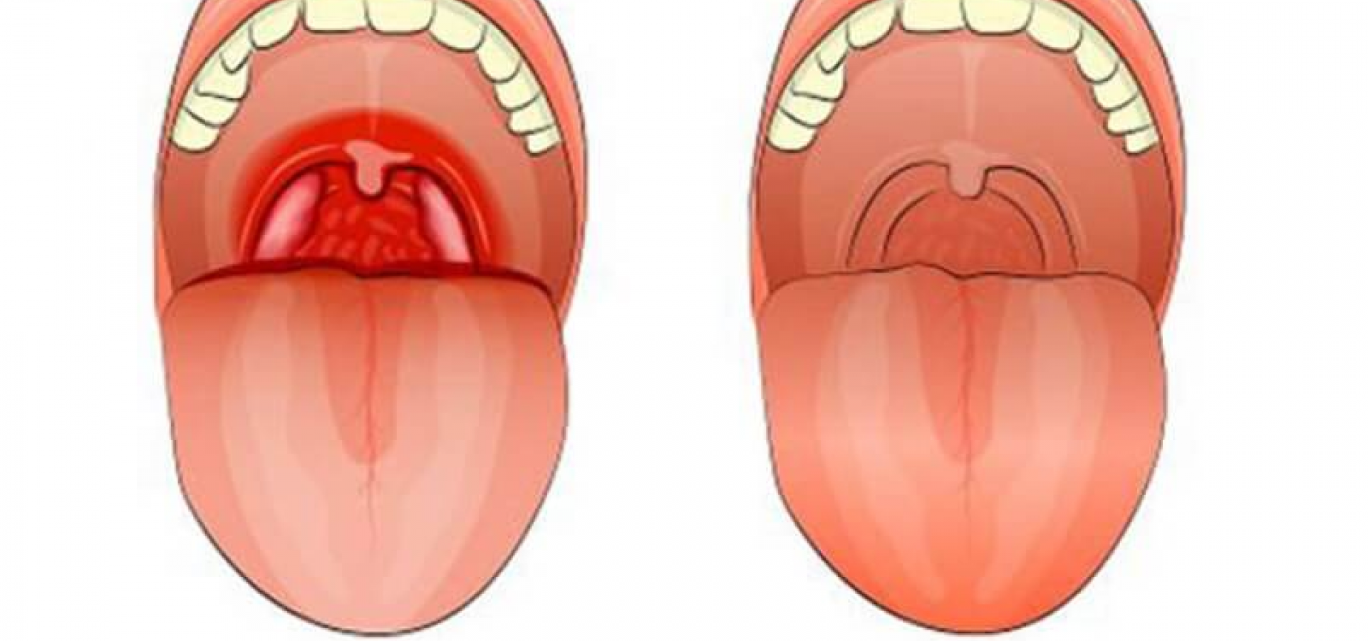Хроническая боль в ухе и горле