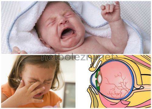Лопнул сосуд в глазу у ребенка: причины, лечение профилактика, особенности у новорожденного
