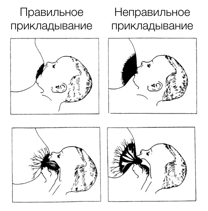 Как правильно прикладывать ребенка для кормления. позы для грудничка, правильное прикладывание к груди - medside.ru