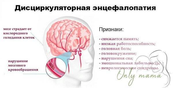 Дисциркуляторная энцефалопатия – что это?