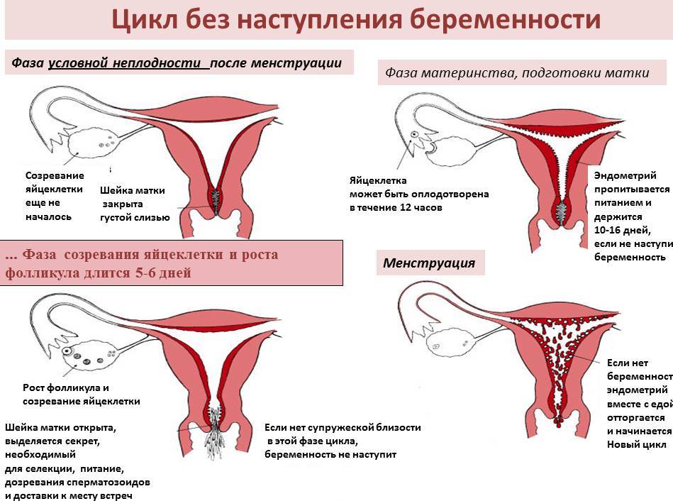 Задержка менструации - стоит ли переживать?