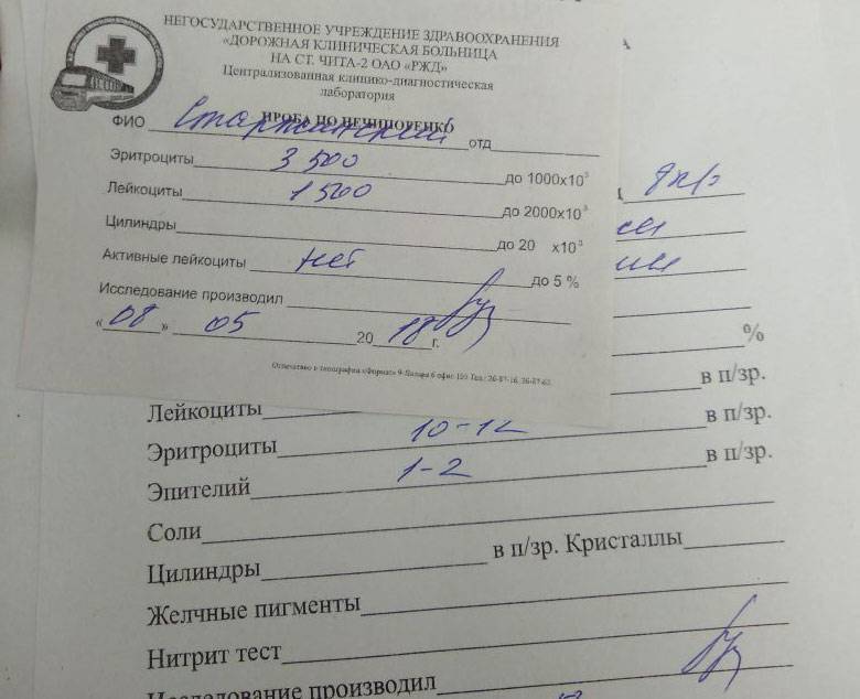 Оам по нечипоренко. Эритроциты в моче 500 по Нечипоренко. Лейкоциты 1000 в моче по Нечипоренко. Моча по Нечипоренко лейкоциты 10. 2. ОАМ В норме, анализ мочи по Нечипоренко..