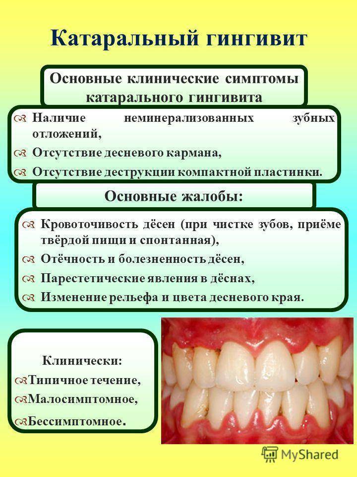 Воспаление десен: признаки, лечение. чем снять воспаление десны около зуба