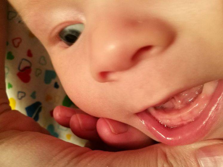 Зубы в 3 месяца: могут ли резаться, признаки прорезывания у грудничков