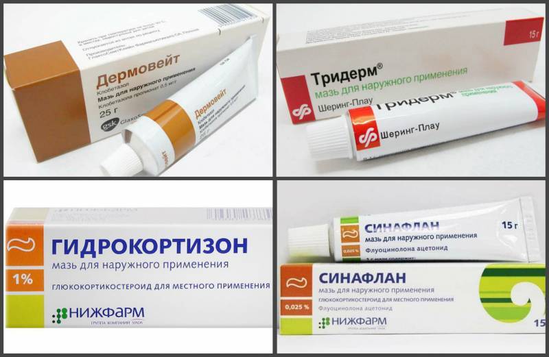 Аллергия на коже у ребенка: причины, лечение, эффективные кремы