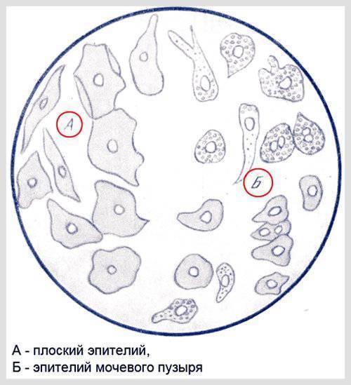 Эритроциты, лецитиновые зерна и клетки эпителия в спермограмме: что это означает? - мытищинская городская детская поликлиника №4
