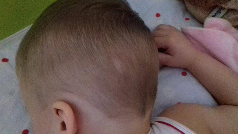 Почему у дочки медленно растут волосы | главный перинатальный - всё про беременность и роды