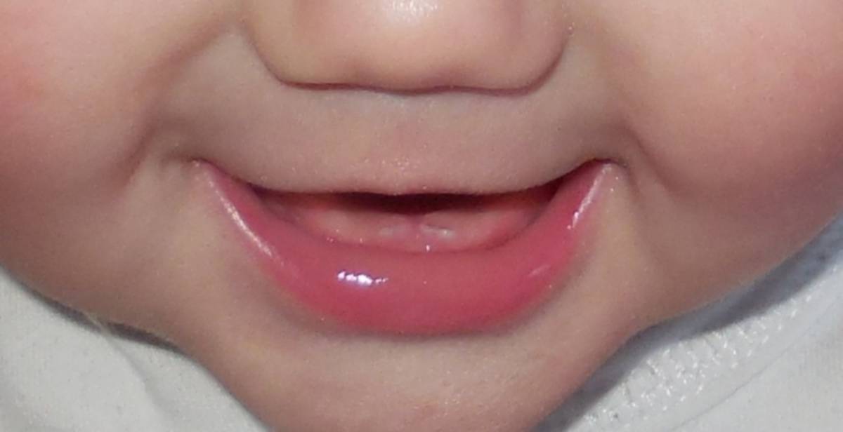 Симптомы прорезывания зубов у детей до года и способы их облегчения | colgate