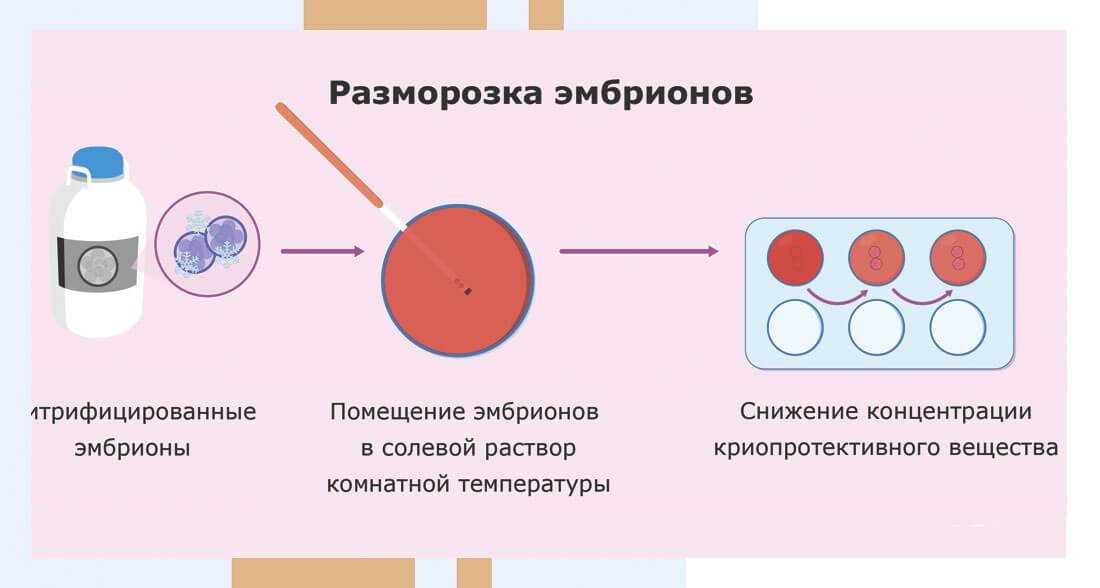 Криоперенос после неудачного эко: когда делать  - статья репродуктивного центра «за рождение»