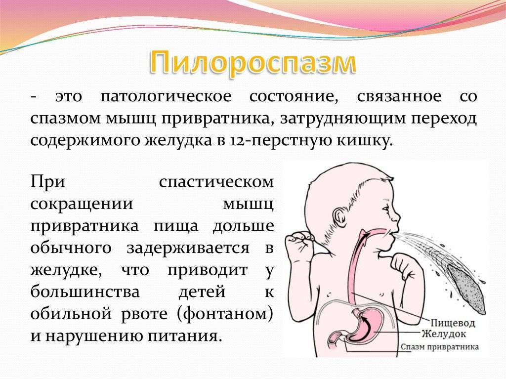 Пилоростеноз врожденный презентация