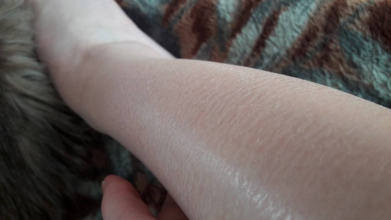 Почему у ребенка шелушится кожа — причины шелушения кожи у детей