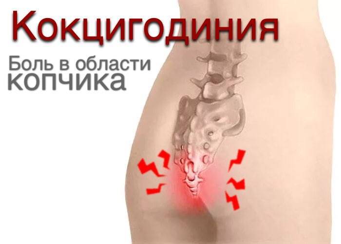 Боль в крестце у мужчин и женщин