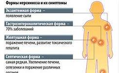 8 серьёзных осложнений кишечных инфекций у детей