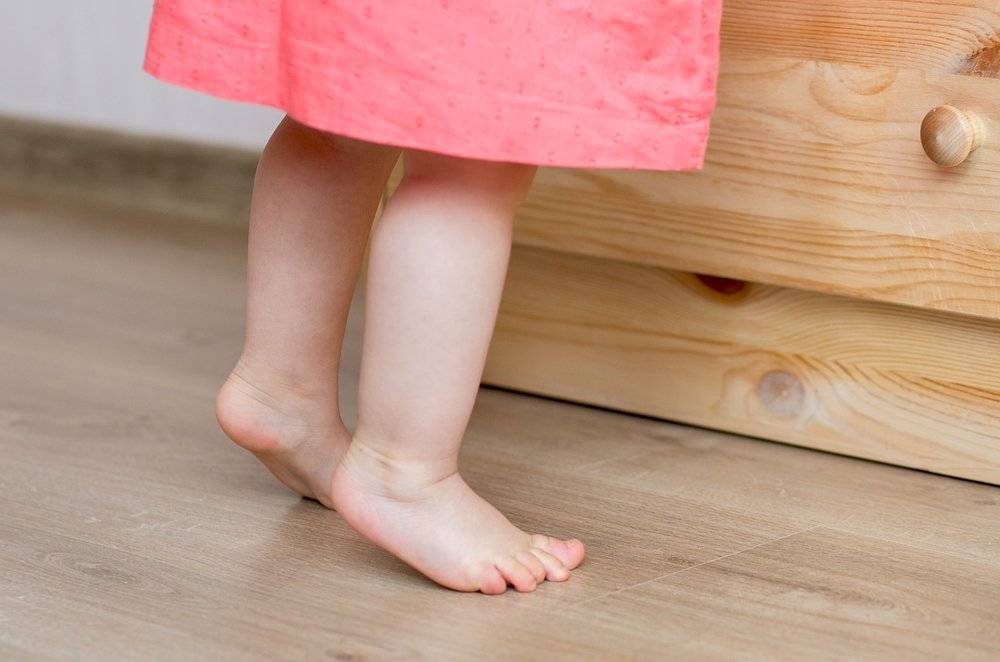 Ребенок в год ходит на носочках причины