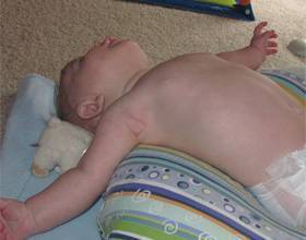 Почему грудной ребенок выгибает спину дугой и запрокидывает голову назад: причины “акробатического мостика”