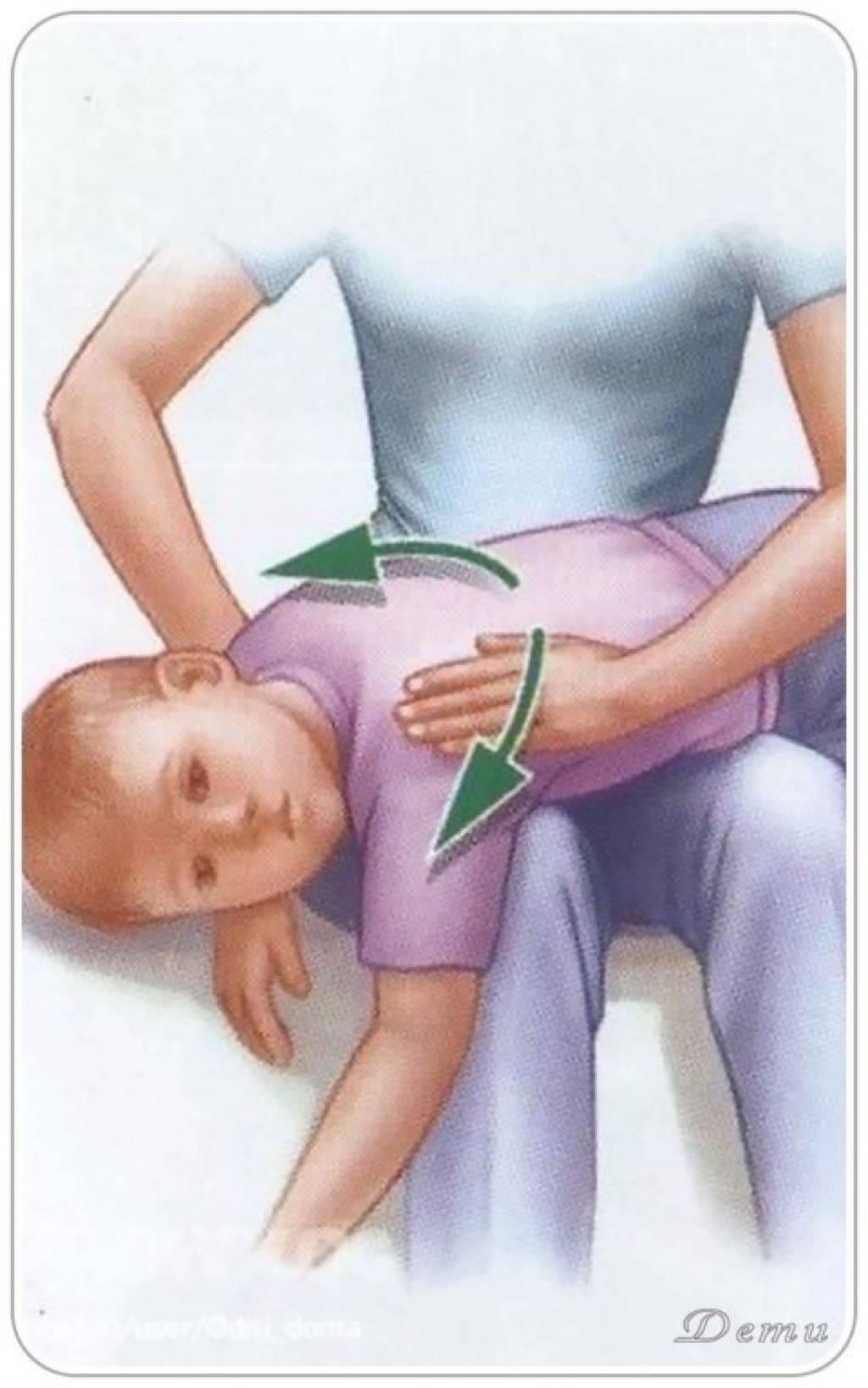 Как вывести мокроту у грудничка? - болталка для мамочек малышей до двух лет - страна мам
