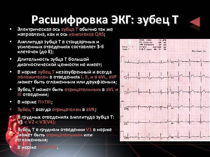 Экг: принцип, регистрация, расшифровка, что показывает, нормальная электрокардиография, патологии в электрокардиограмме, как проходит диагностика, методы и когда нужно делать