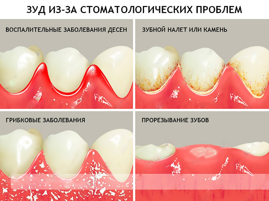 Причины белых пятен на зубах у детей, что делать| colgate®