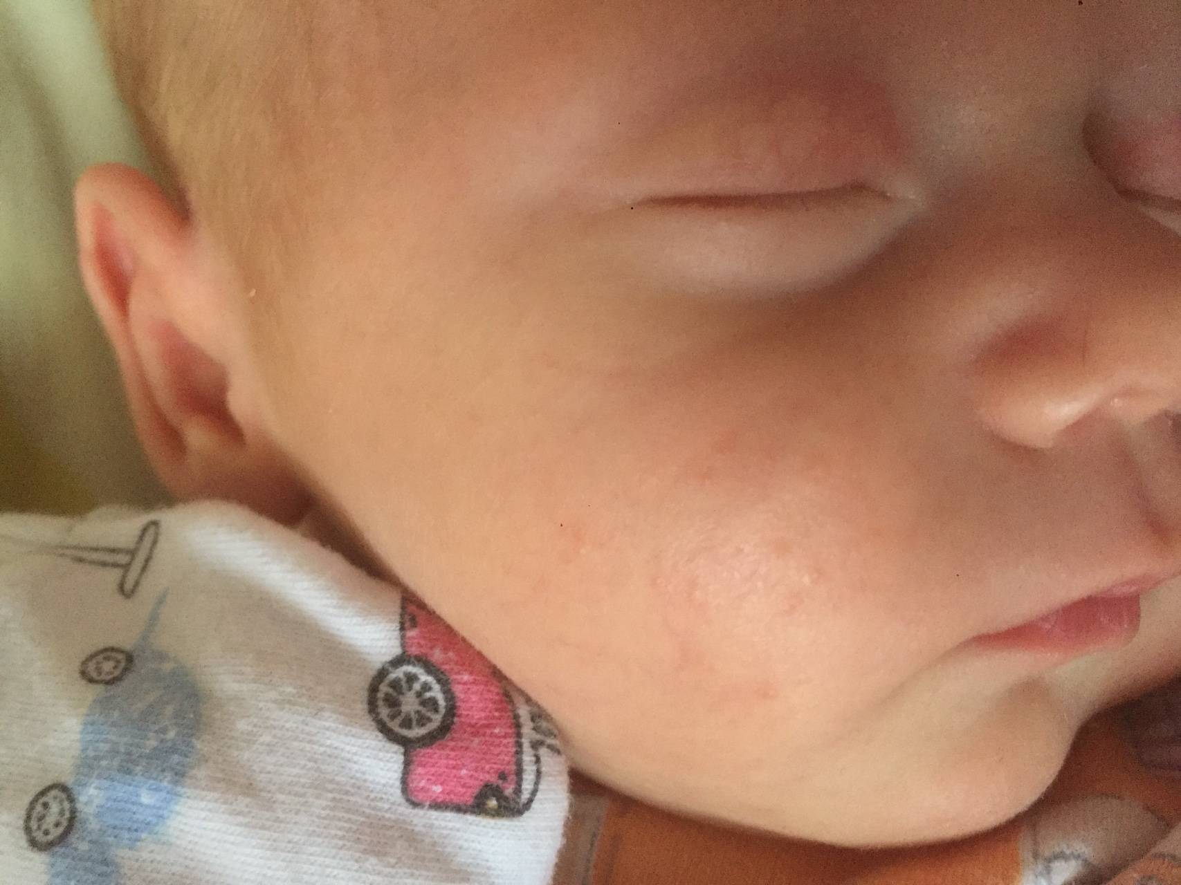 Раздражение на коже у ребенка: причины и эффективные средства