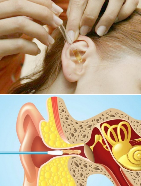 Лечение шума в ушах и голове: причины