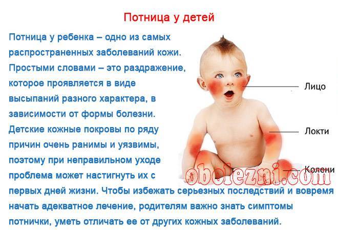 Потница у новорожденных: фото потнички у ребенка, симптомы и лечение