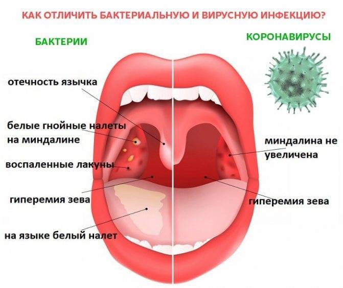 Болезни полости рта