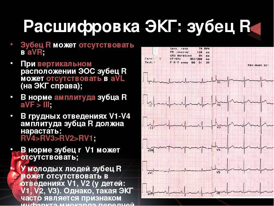 Плохое экг у грудничка - вопрос кардиологу - 03 онлайн
