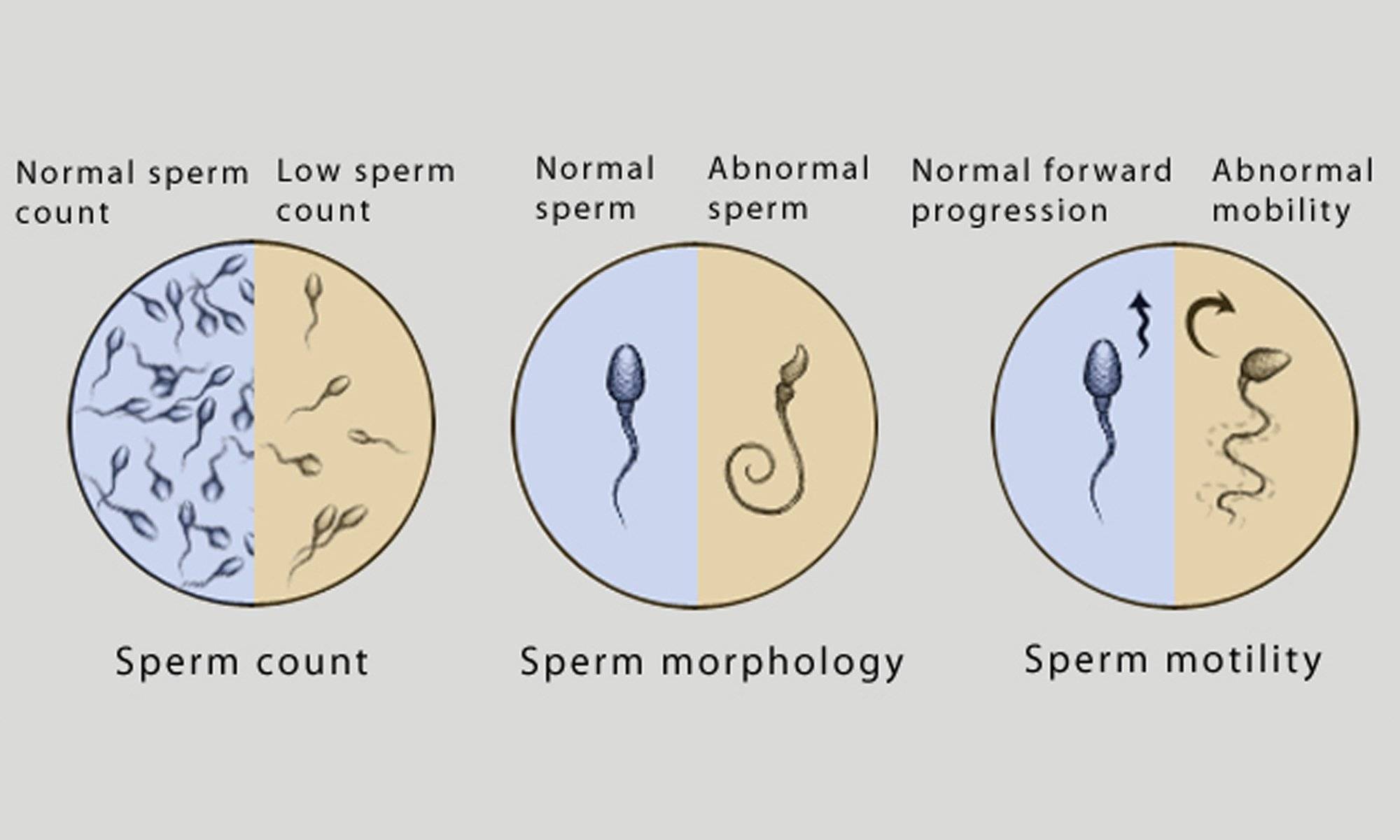 что означает когда у мужчины мало спермы (120) фото