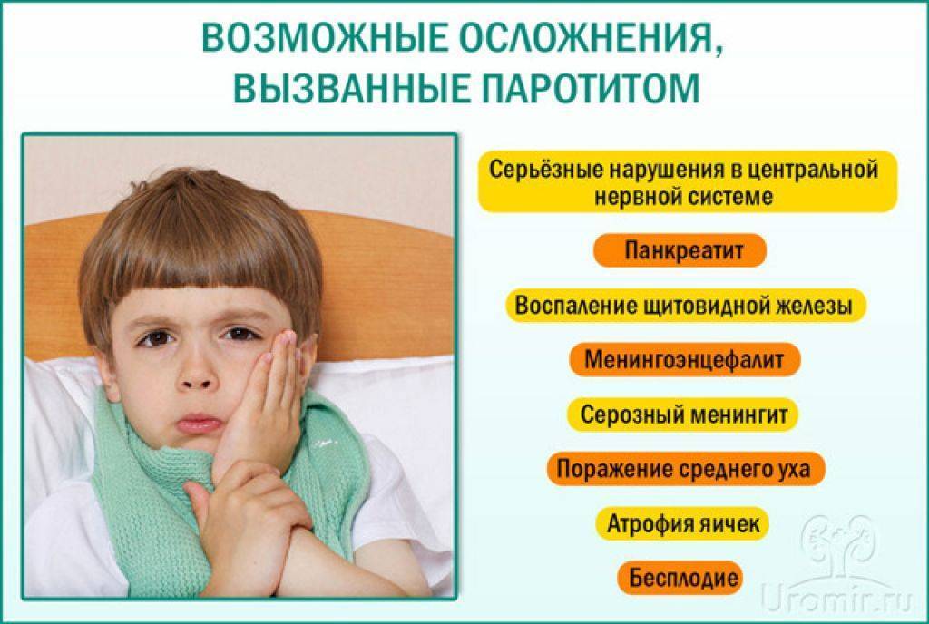 Эпидемический паротит (свинка): вирус, симптомы у детей и взрослых, лечение. последствия заболевания у мальчиков. фото